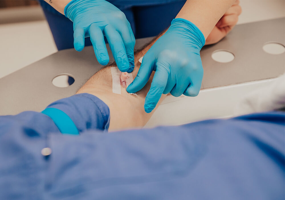 Eine Krankenschwester mit blauen Handschuhen, die immer ansprechbar ist, führt einen intravenösen Katheter in den Arm eines Patienten ein, der auf einem medizinischen Tisch liegt, und passt ihn an.